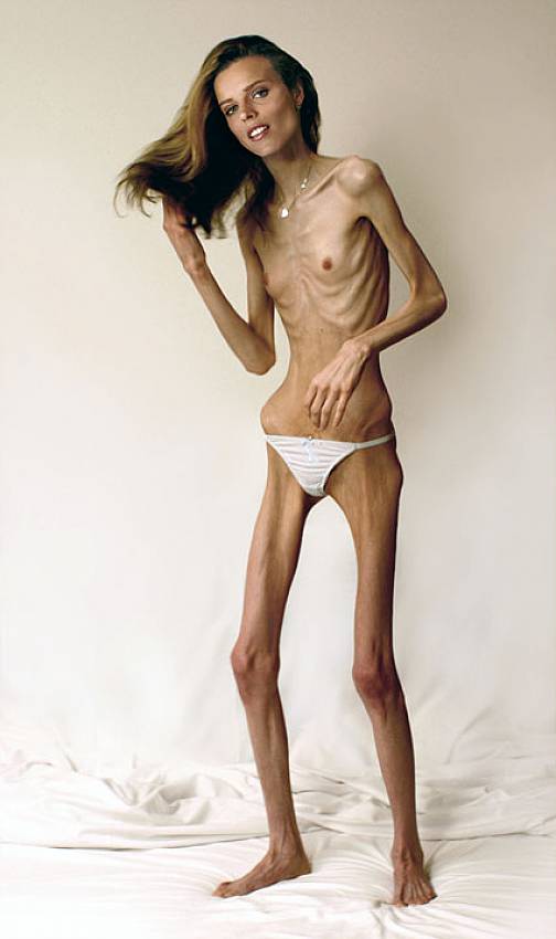Skinny Nude Girls Pics